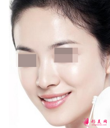 超光子嫩肤成效可以维持多长时间