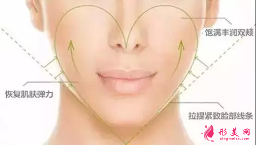 自体脂肪填充脸部会有硬块吗