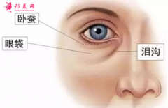 手术祛眼袋后可以化妆吗？
