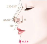 自体软骨隆鼻哪里做得比较好？
