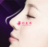 广州假体隆鼻哪里好一些？