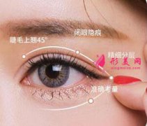 广州切开双眼皮哪里比较好？