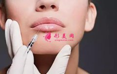 自体脂肪丰嘴唇效果怎么样有哪些优点?原理是什么?