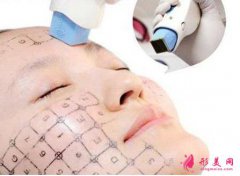 热玛吉一次多少钱?原理是什么?