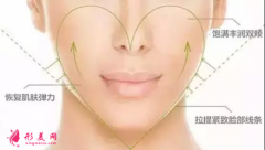 自体脂肪填充脸部是怎么收费的？