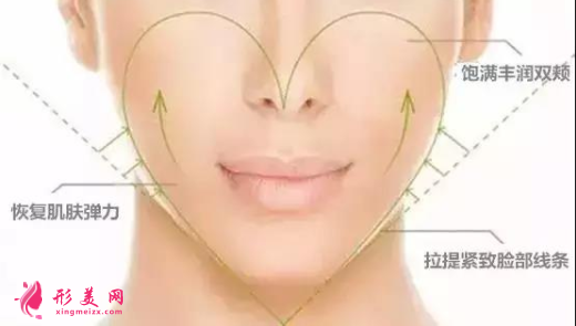 自体脂肪填充脸部是怎么收费的