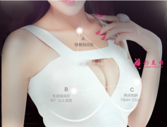 自体脂肪隆胸术前要注意什么？