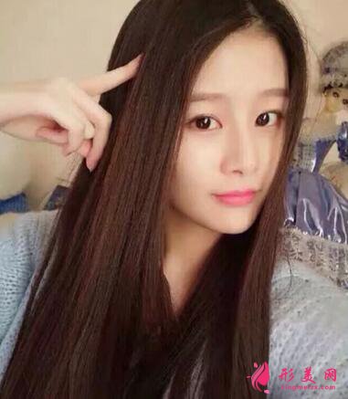 #术前了解#热玛吉除皱能维持多久？效果好不好呢？
