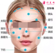 自体脂肪填充面部需要注射多少次？