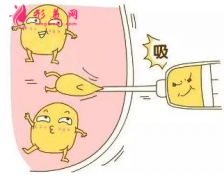 吸脂减肥的恢复期是多久？