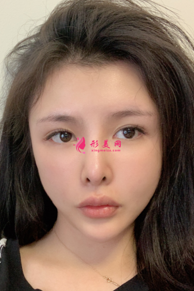 TIM截图20200812160145_resized.png