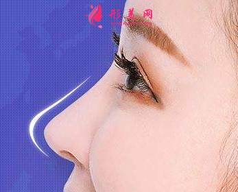 假体隆鼻整形需要多久恢复好