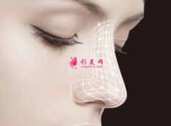 肋软骨隆鼻一般要多少钱？