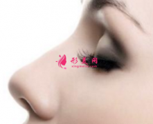 假体隆鼻一般什么时候消肿？