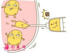 吸脂减肥什么时候可以恢复正常活动？