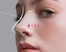 软骨隆鼻的效果能维持多久？