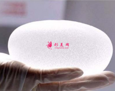 假体隆胸效果能保持几年呢？
