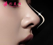 自体软骨隆鼻常见的软骨材料