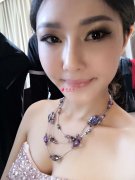 开眼角手术大约需要多少钱？