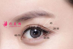 石家庄天伊美整形开眼角多少钱？