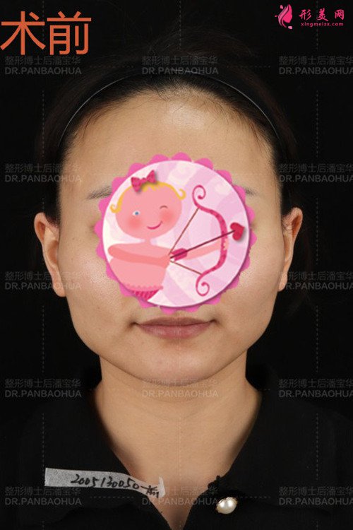 重庆华美潘宝华磨骨怎么样