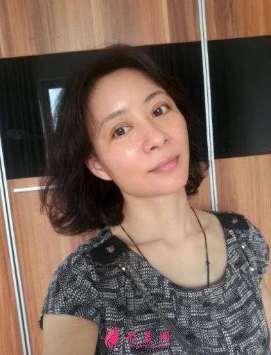 北京瑞丽冯立哲多维拉面部提升怎么样？案例及效果图公开查询
