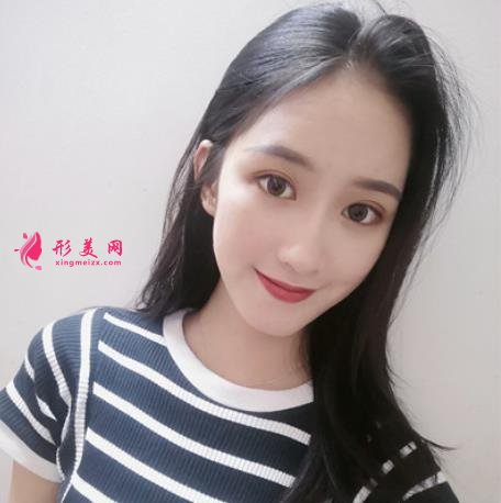 上海九院口腔科种植牙专家哪个好？真人案例及价格收费展现！