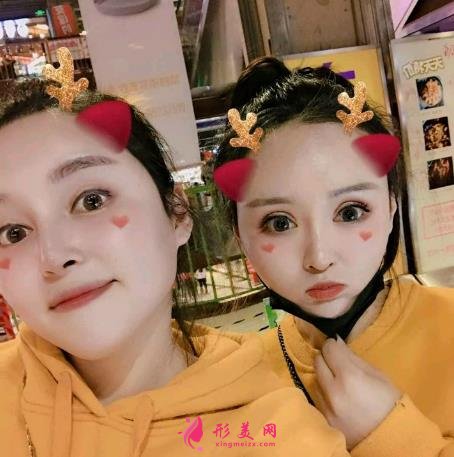 杭州美莱高士乾做的鼻子怎么样？2021隆鼻案例+价格表曝光