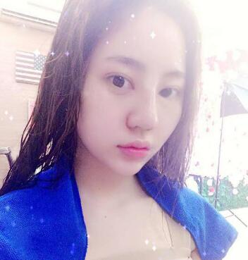 鼻综合整形前后对比图和恢复过程