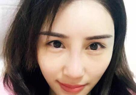 鼻子综合整形前后对比图