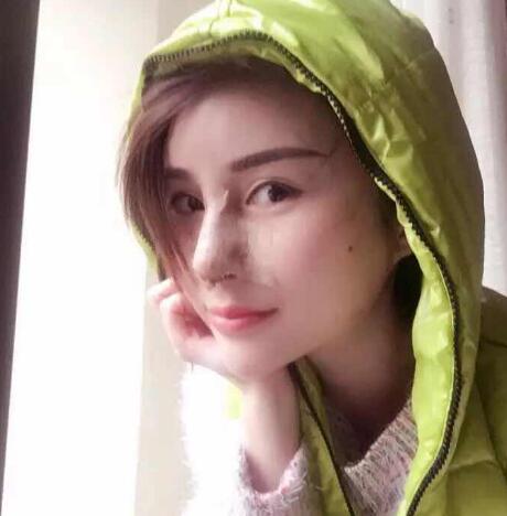 在南京明基医院做的鼻子综合整形手术价格14500元