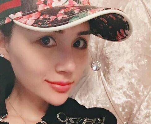 鼻子综合整形前后对比图